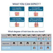 Load image into Gallery viewer, Aimanfun Laser Red Light Therapy for Hair Growth - FDA Cleared Hair Loss, Hair Thinning & Alopecia Treatment for Men & Women - Laser Cap for Hair Regrowth Stimulate Denser Fuller Hair