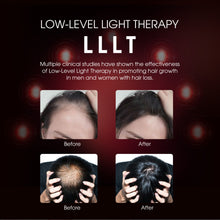 Load image into Gallery viewer, Aimanfun Laser Red Light Therapy for Hair Growth - FDA Cleared Hair Loss, Hair Thinning & Alopecia Treatment for Men & Women - Laser Cap for Hair Regrowth Stimulate Denser Fuller Hair