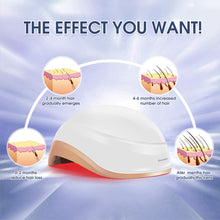 Load image into Gallery viewer, Aimanfun Laser Red Light Therapy for Hair Growth - FDA Cleared Hair Loss, Hair Thinning & Alopecia Treatment for Men & Women - Laser Cap for Hair Regrowth Stimulate Denser Fuller Hair