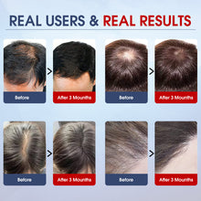 Load image into Gallery viewer, Aimanfun Laser Red Light Therapy for Hair Growth - FDA Cleared Hair Loss, Hair Thinning & Alopecia Treatment for Men & Women - Laser Cap for Hair Regrowth Stimulate Denser Fuller Hair