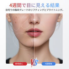 Load image into Gallery viewer, EMSマイクロ電流痩顔器、光治療による若肌と振動痩顔による顔脂肪減少V型顔
