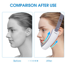 将图片加载到图库查看器,V面部机面部按摩器电动面部按摩器高频振动抗老化面膜升降皮肤升降装置,电动V面部成型按摩器