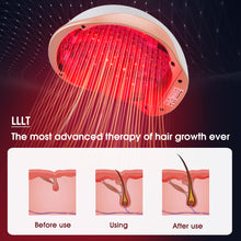 Load image into Gallery viewer, Aimanfun Laser Red Light Therapy for Hair Growth - FDA Cleared Hair Loss, Hair Thinning & Alopecia Treatment for Men & Women - Laser Cap for Hair Regrowth Stimulate Denser Fuller Hair
