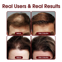 Load image into Gallery viewer, Aimanfun Laser Red Light Therapy for Hair Growth - FDA Cleared Hair Loss, Hair Thinning & Alopecia Treatment for Men & Women - Laser Cap for Hair Regrowth Stimulate Denser Fuller Hair