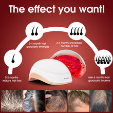 Load image into Gallery viewer, Aimanfun Laser Red Light Therapy for Hair Growth - FDA Cleared Hair Loss, Hair Thinning & Alopecia Treatment for Men & Women - Laser Cap for Hair Regrowth Stimulate Denser Fuller Hair