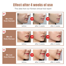 Load image into Gallery viewer, Aimanfun Skin Tightening And Lifting Device