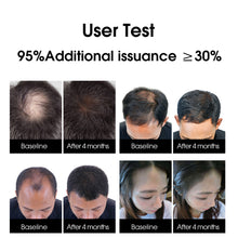Load image into Gallery viewer, Aimanfun Smart Laser Hair Growth Comb