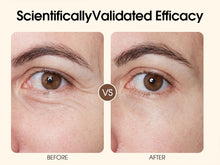 Load image into Gallery viewer, Aimanfun EMS Eye Wrinkles Reduction Fine Lines and Wrinkles Around Eyes
